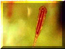 tentacolo drosera sessilifolia