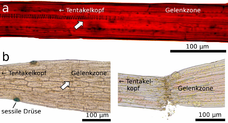 Bild 4: Gelenkzone